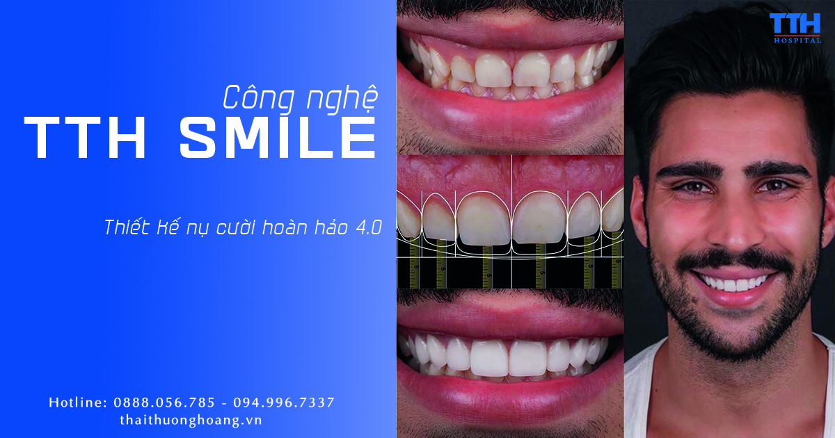 CÔNG NGHỆ TTH SMILE LÀ GÌ? CÔNG NGHỆ THIẾT KẾ NỤ CƯỜI HOÀN HẢO 4.0 2021